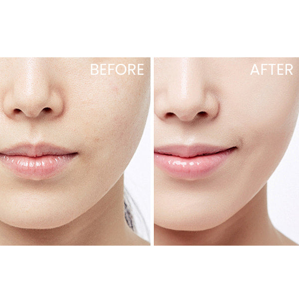 CeraVe Moisturizing Lotion